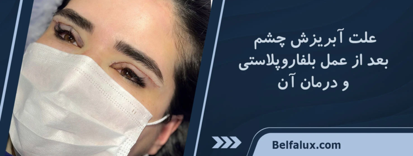 آبریزش چشم بعد از عمل بلفاروپلاستی