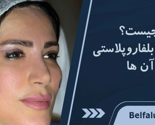 بلفاروپتوز چیست