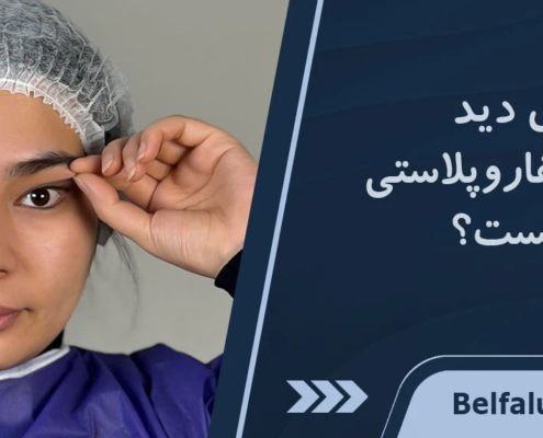 علت تاری دید بعد از عمل بلفاروپلاستی