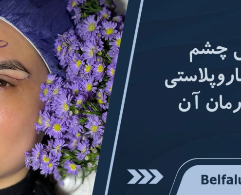 خارش چشم بعد از عمل بلفاروپلاستی