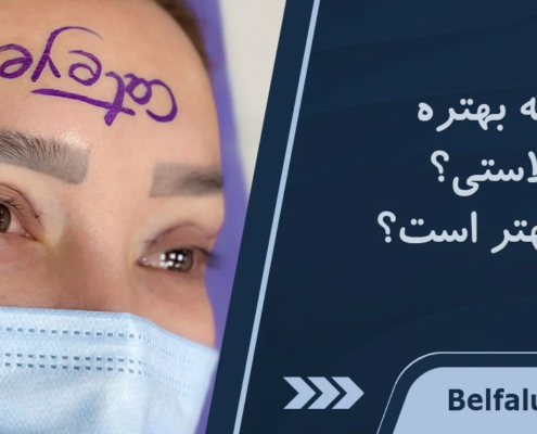 لیفت شقیقه بهتره یا بلفاروپلاستی