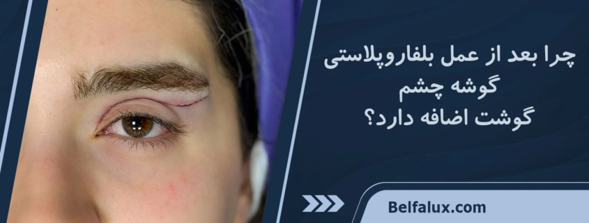 گوشت اضافه بعد از عمل پلک