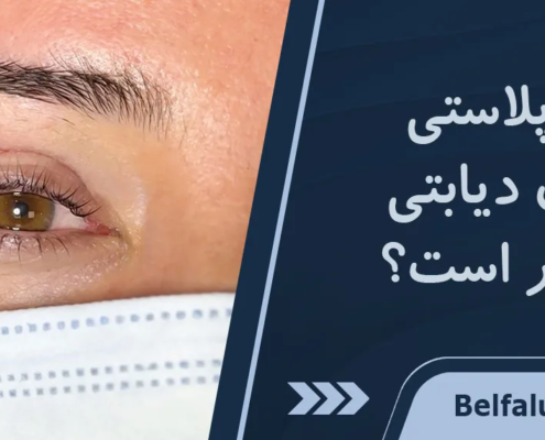 بلفاروپلاستی در افراد دیابتی