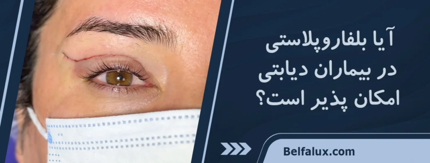 بلفاروپلاستی در افراد دیابتی