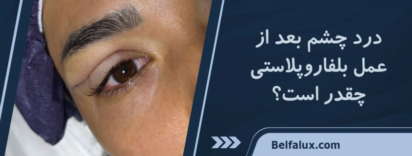 عمل بلفاروپلاستی درد دارد