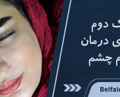 چگونه بفهمیم پلک دوم داریم