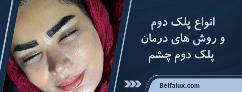 چگونه بفهمیم پلک دوم داریم