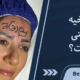 بلفاروپلاستی با لیزر