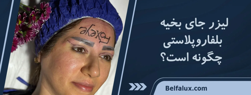 بلفاروپلاستی با لیزر