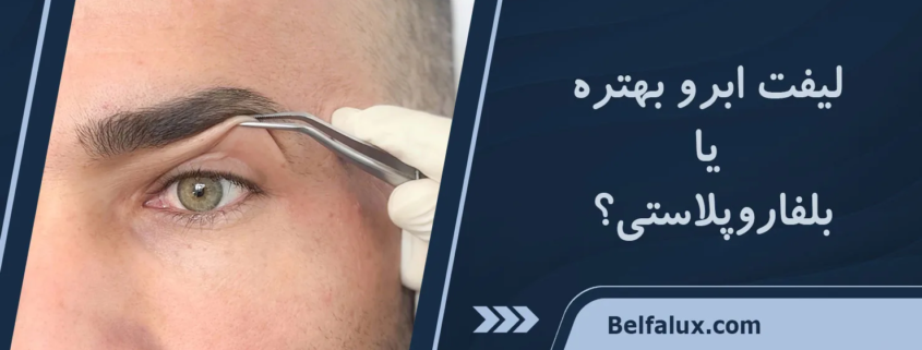 لیفت ابرو بهتره یا بلفاروپلاستی