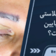 مراقبت بعد بلفاروپلاستی