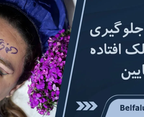 ورزش افتادگی پلک