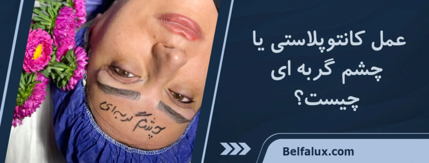 کانتو پلاستی چیست