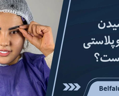 کشیدن بخیه بلفاروپلاستی