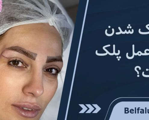 کوچک شدن چشم بعد از عمل پلک