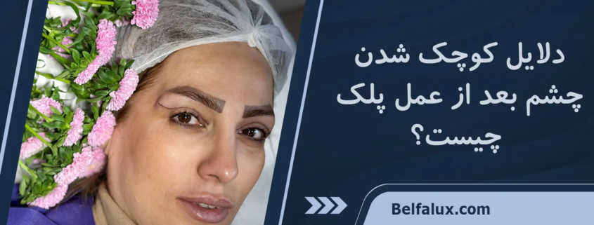 کوچک شدن چشم بعد از عمل پلک