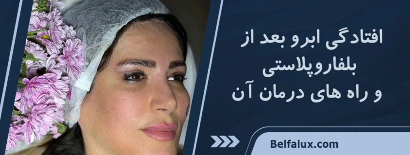 افتادگی ابرو بعد از بلفاروپلاستی