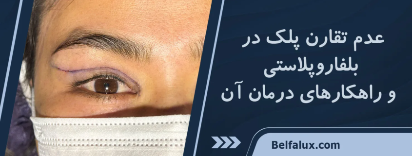 عدم تقارن چشم بعد از بلفاروپلاستی