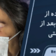 کمپرس گرم بعد از عمل پلک